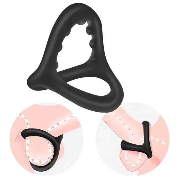 Penis- und Hodenring mit Noppenoberfläche (schwarz)