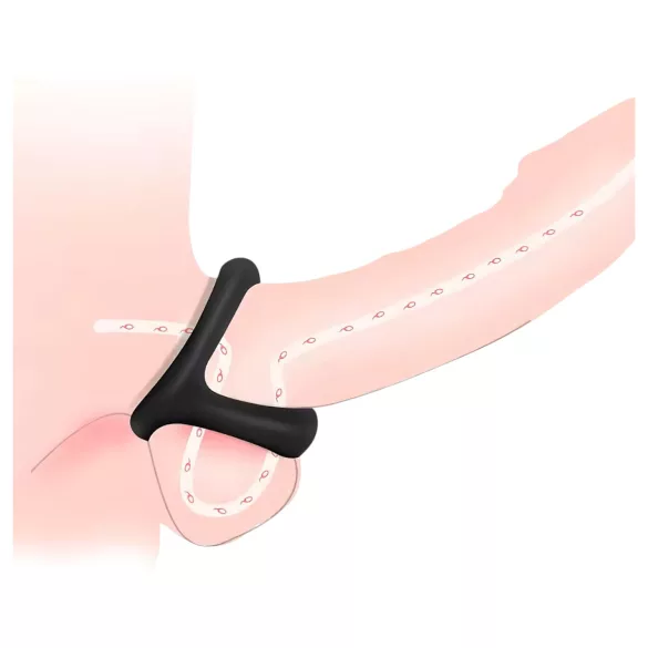 Penis- und Hodenring mit Noppenoberfläche (schwarz)